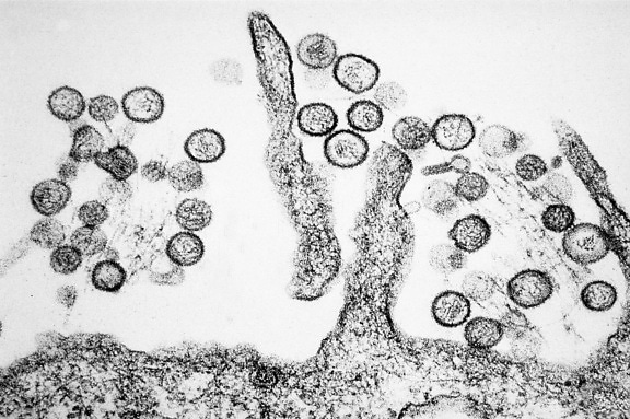 This is a microscopic picture of rodent droppings that contain Hantavirus.